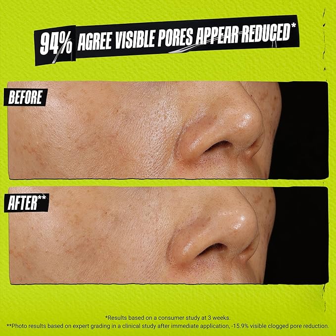 Kiehl's Rare Earth Pore Minimizer Face Mask, with Bentonite and Amazonian White Clay and Allantoin, Oil Absorbing Facemask for Normal to Oily Skin - 4.2 fl oz