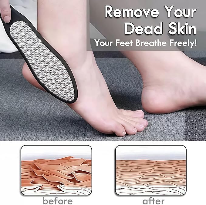 3 in 1 Large Size Durable Foot File Callus Remover (1 Pc) with Double Sided Stainless Heel Scraper for Cracked Heels, Pedicure Tools for Feet Ped Egg for Feet with Coarse and Fine Sides.