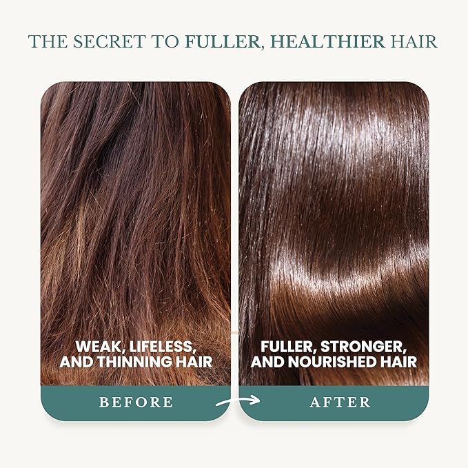 Rosemary Oil Shampoo with Biotin for Thinning Hair & Anti-Hair Loss, Strengthening Botanical Formula, Women & Men, Sulfate-Free, Organic, 16 fl oz