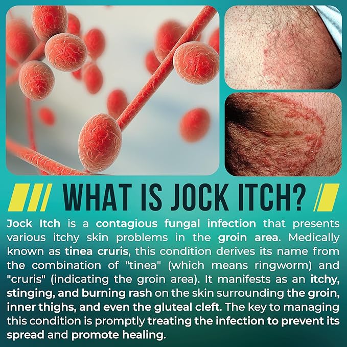 Jock Itch Powder with Miconazole Nitrate 2% & Tea Tree Oil for Itch, Odor & Rash Relief | Jock Itch Treatment Removes Germs & Fungus | Soothes Burning Skin & Reinfection | Pack of 3