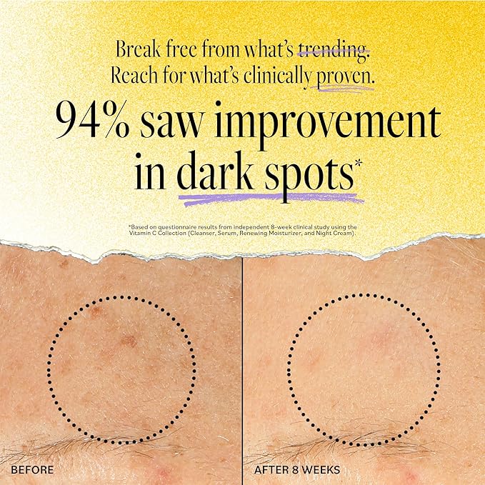 Derma E Vitamin C Daily Brightening Cleanser, 6 Fl Oz, Hydrating Cleanser to Help Even Skin Tone, Moisturizing Face Wash for a Radiant Glow