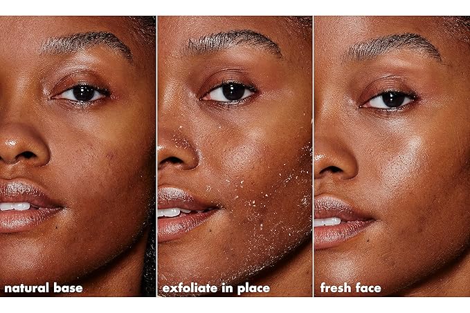 e.l.f. SKIN Gentle Peeling Exfoliant, Cleanser, Effective, Easy to Apply, Peels Away Dead Skin, Removes Dirt, Ideal for All Skin Types
