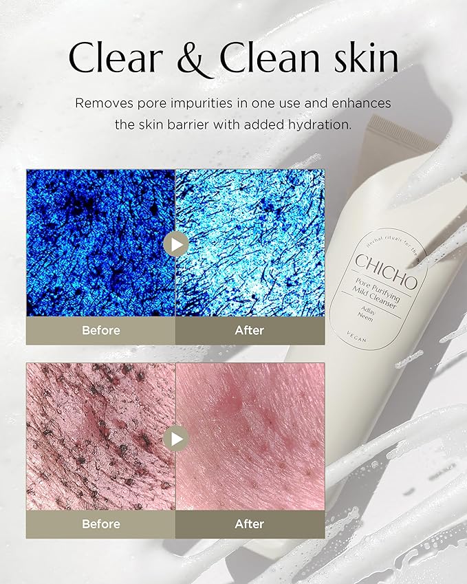CHICHO Korean Pore Purifying Mild Cleanser with Job's Tears Seed Powder 10,000ppm, PHA, 5 Ceramides 84% - Deep Cleansing & Exfoliating Hydrating Face Wash for Sensitive Skin, 4.05 fl.oz.