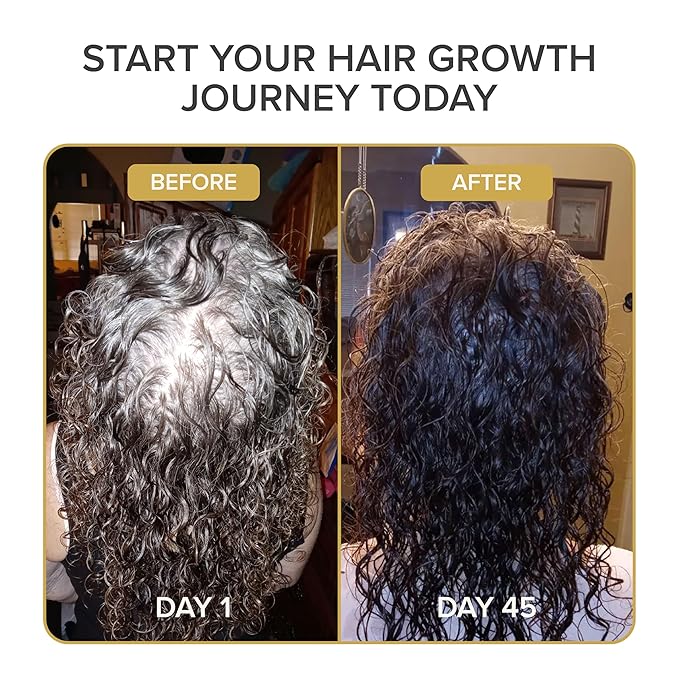 Shedavi Iconic Vegan Hair Serum with Botanicals - Growth Treatment for Women & Men's Dry, Damaged Hair and Scalp with Argan, Coconut, Castor, and Tea Tree Oils