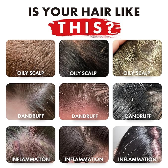 ALFHEIM Rosemary+ Purifying Shampoo & Conditioner Set – Balancing Hair Care for Oily & Fine Hair with Rosemary, Peppermint & Jojoba Oils – Deep Cleanse, Lightweight Hydration, Sulfate Free, 33.8 oz x2